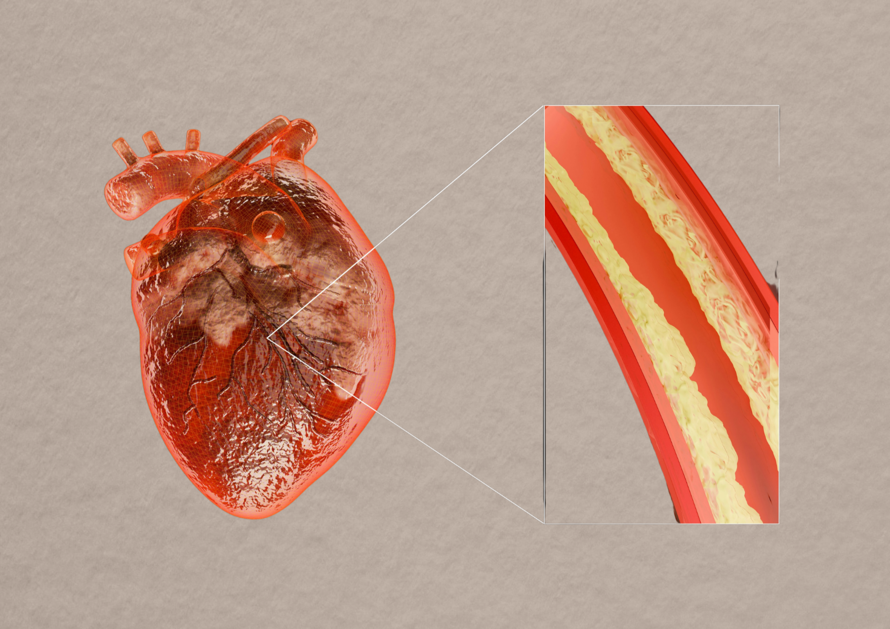 Cholesterol: wat een hoge waarde betekent en wat je eraan kunt doen